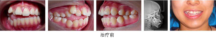 mg冰球突破豪华版试玩(中国)官方网站