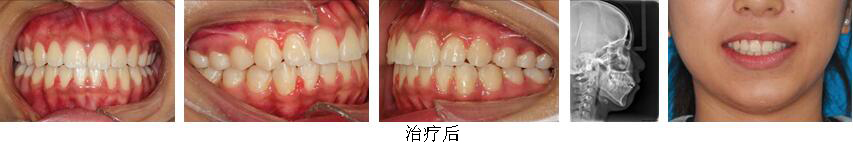 mg冰球突破豪华版试玩(中国)官方网站