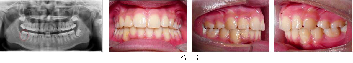 mg冰球突破豪华版试玩(中国)官方网站