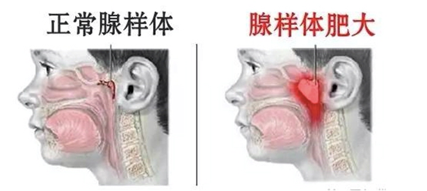 mg冰球突破豪华版试玩(中国)官方网站