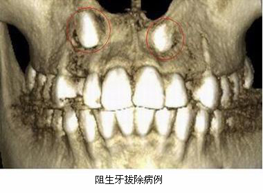 mg冰球突破豪华版试玩(中国)官方网站