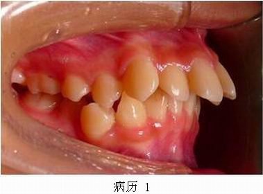 mg冰球突破豪华版试玩(中国)官方网站