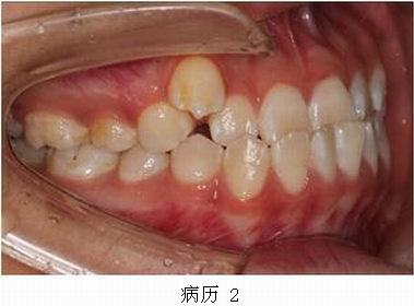 mg冰球突破豪华版试玩(中国)官方网站